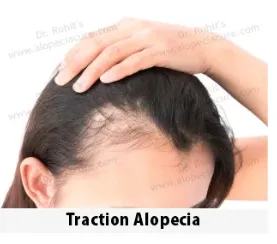 Skincare peel